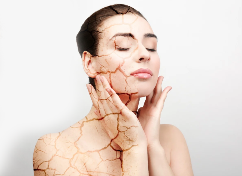 <strong>Veja como não deixar a maquiagem craquelada</strong>