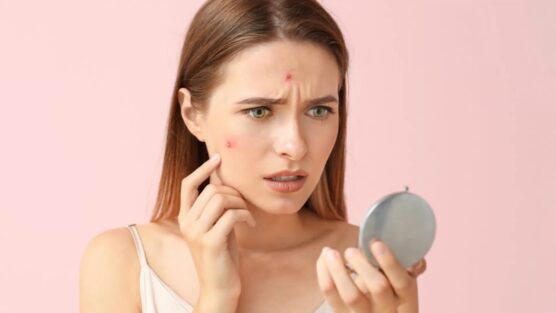 O que causa oleosidade no rosto? Entenda!